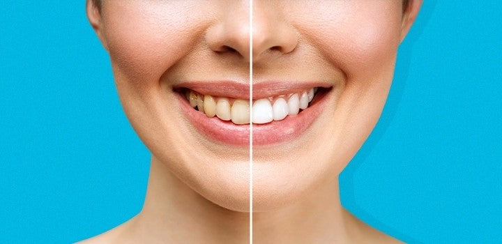 The Quiet Revolution in Oral Care: Why Your Toothbrush Shape Matters More Than You Think